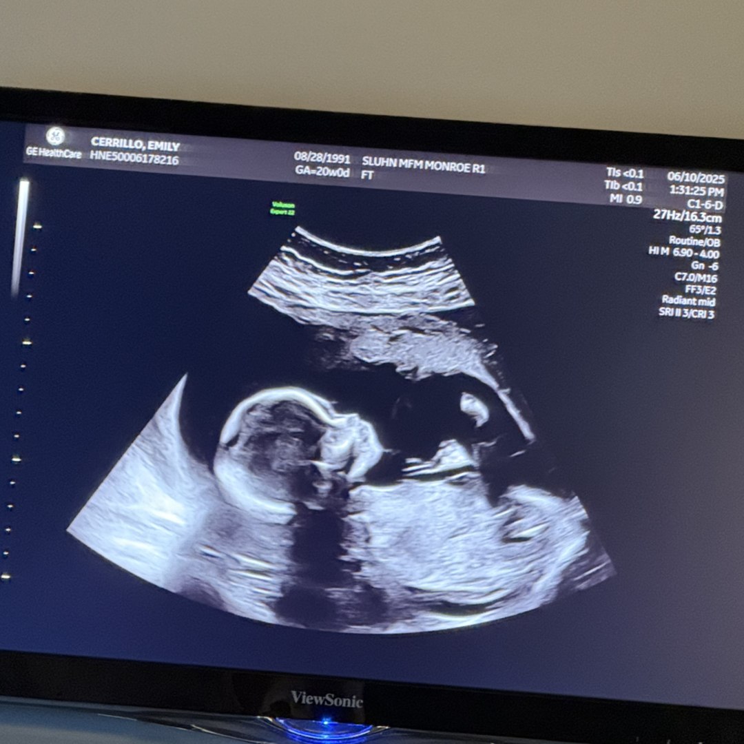 Photo shared by Emily for their Babylist baby registry.