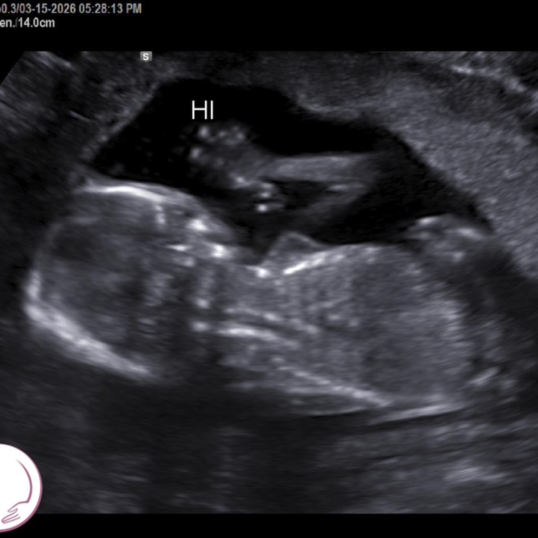 Photo shared by Natalie for their Babylist baby registry.