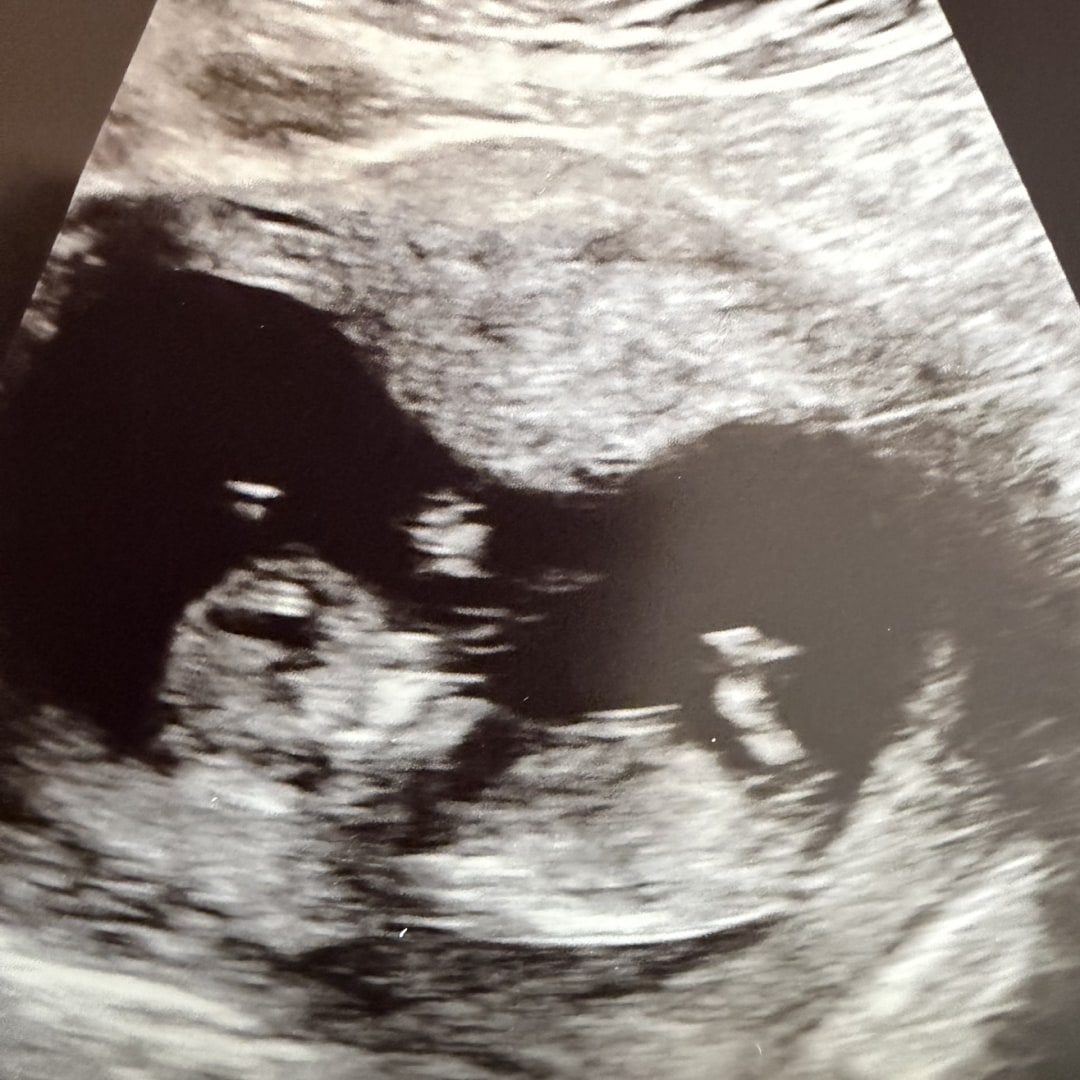 Photo shared by Diana for their Babylist baby registry.