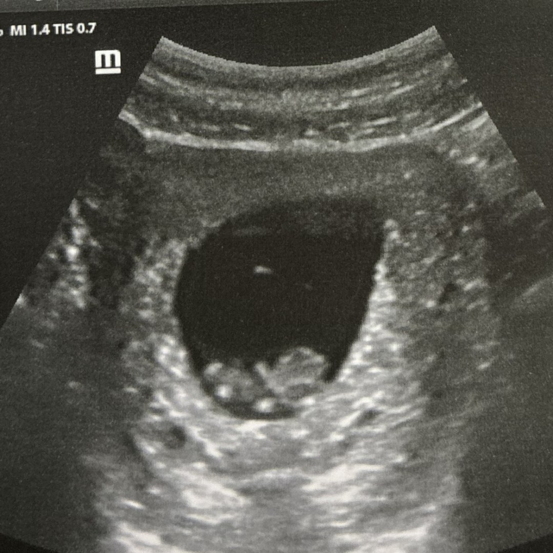 Photo shared by Chazlyn for their Babylist baby registry.