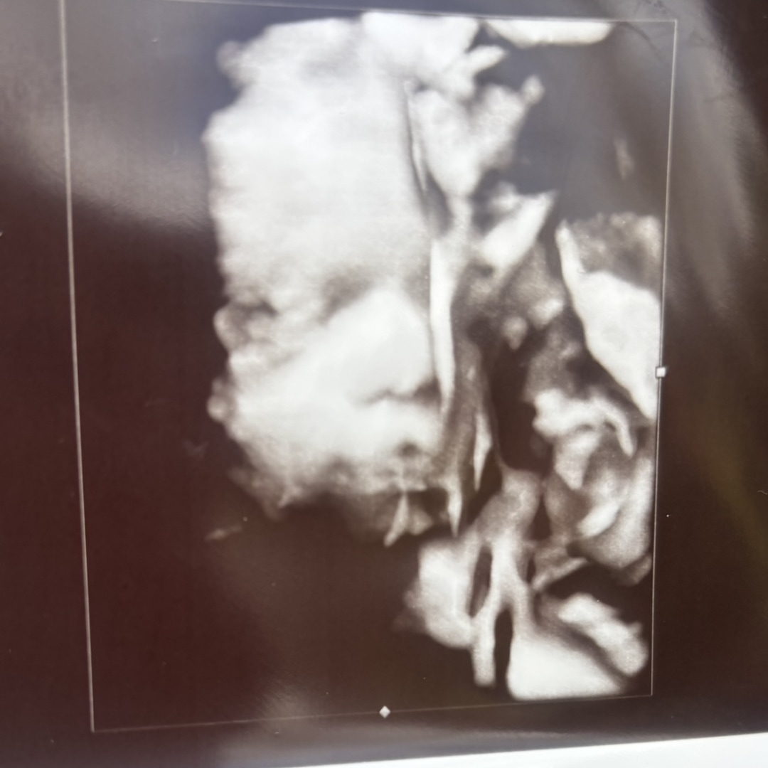 Photo shared by Jahmese for their Babylist baby registry.