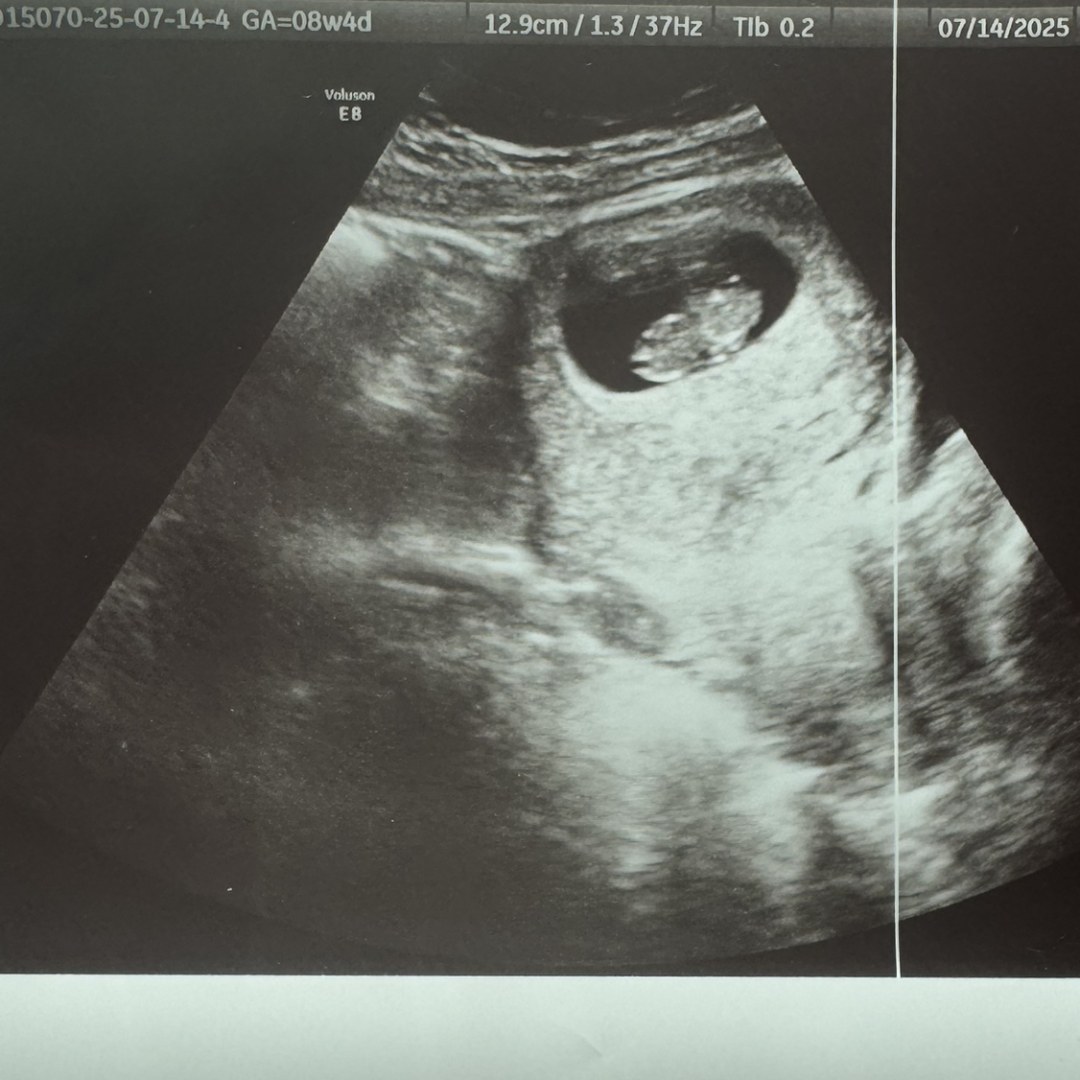 Photo shared by Gabbie for their Babylist baby registry.
