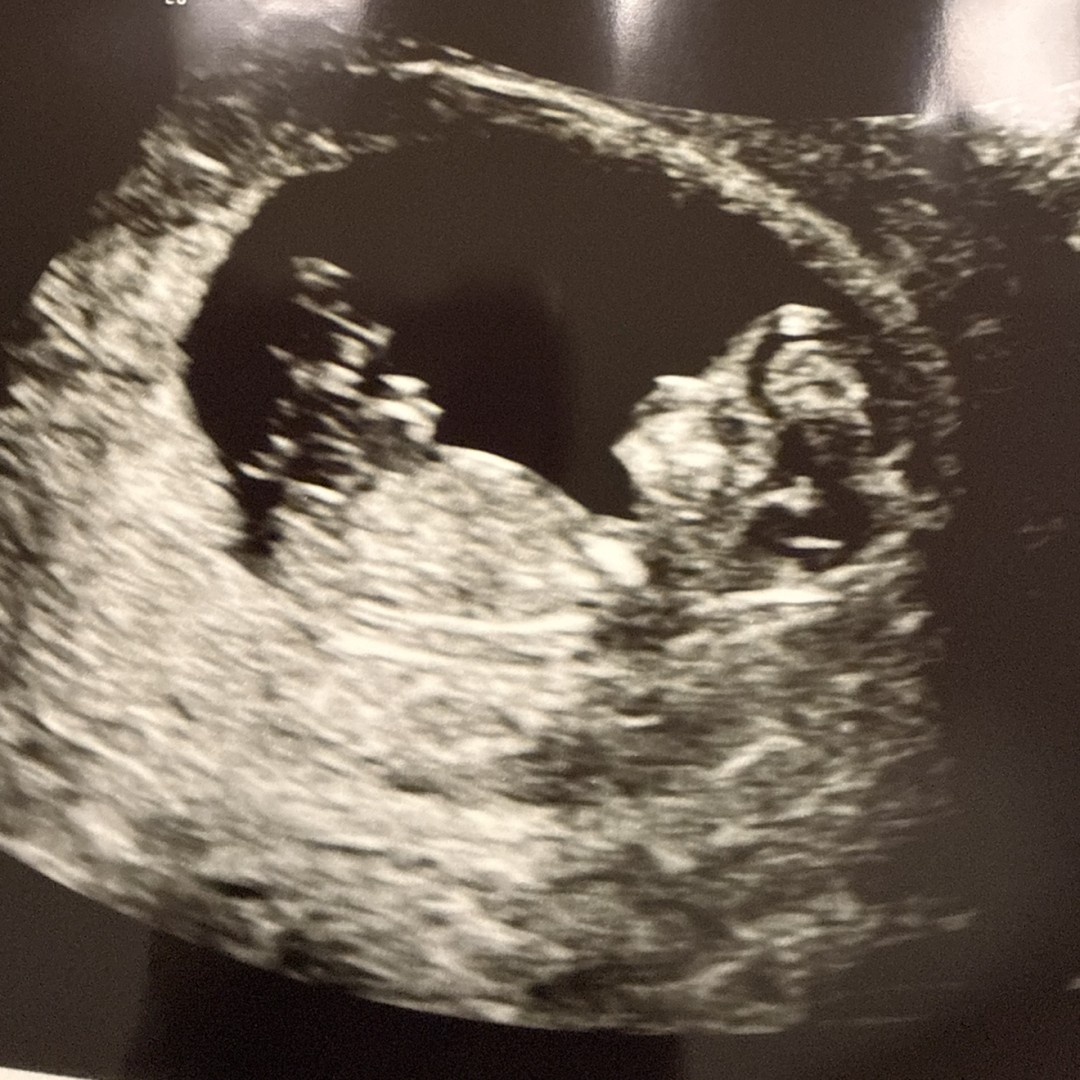 Photo shared by Taylor for their Babylist baby registry.