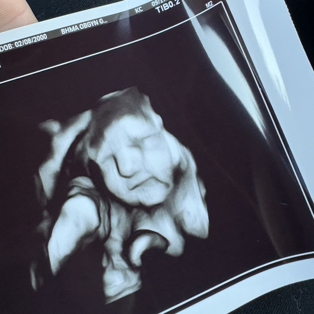 Photo shared by Alexis for their Babylist baby registry.