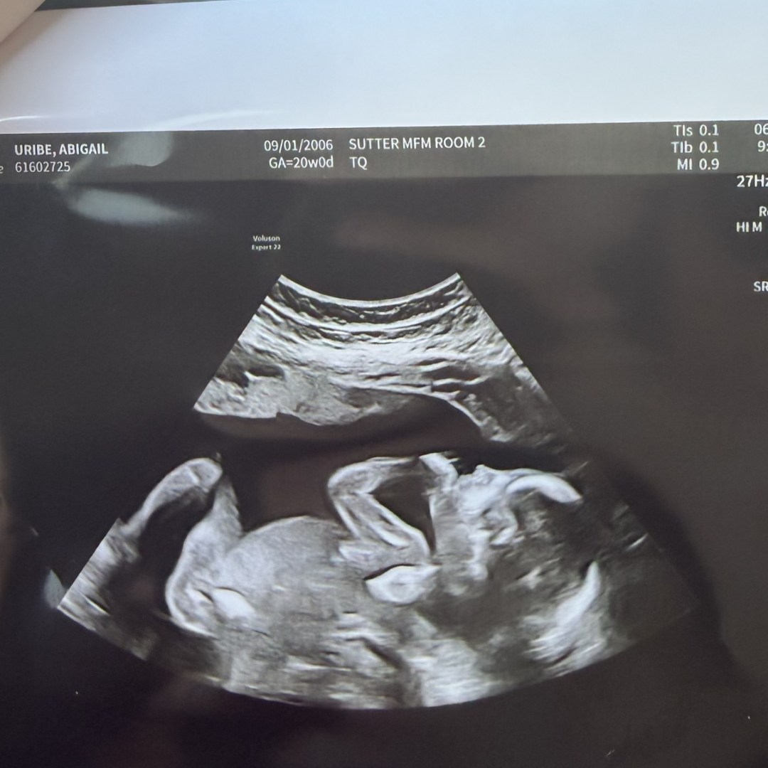 Photo shared by Abigail for their Babylist baby registry.