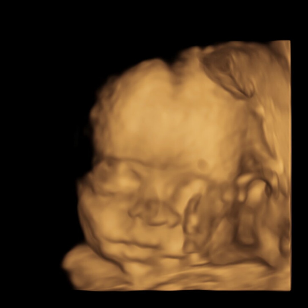 Photo shared by Alexis for their Babylist baby registry.