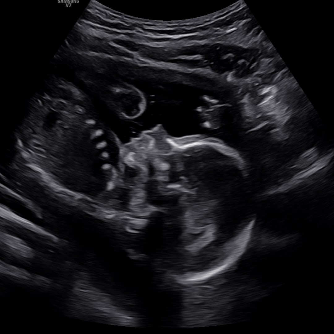 Photo shared by Jaida for their Babylist baby registry.
