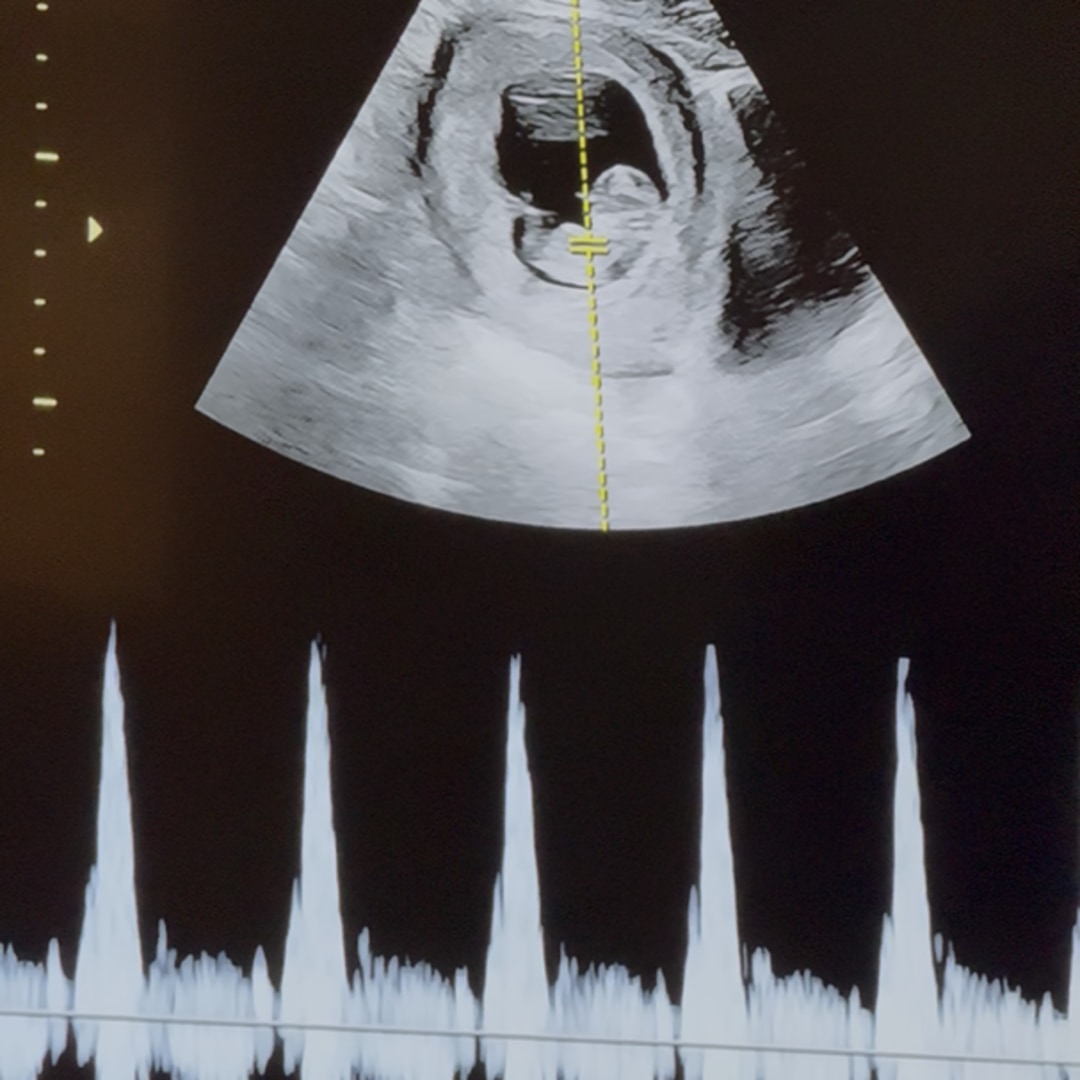 Photo shared by Kaitlyn for their Babylist baby registry.