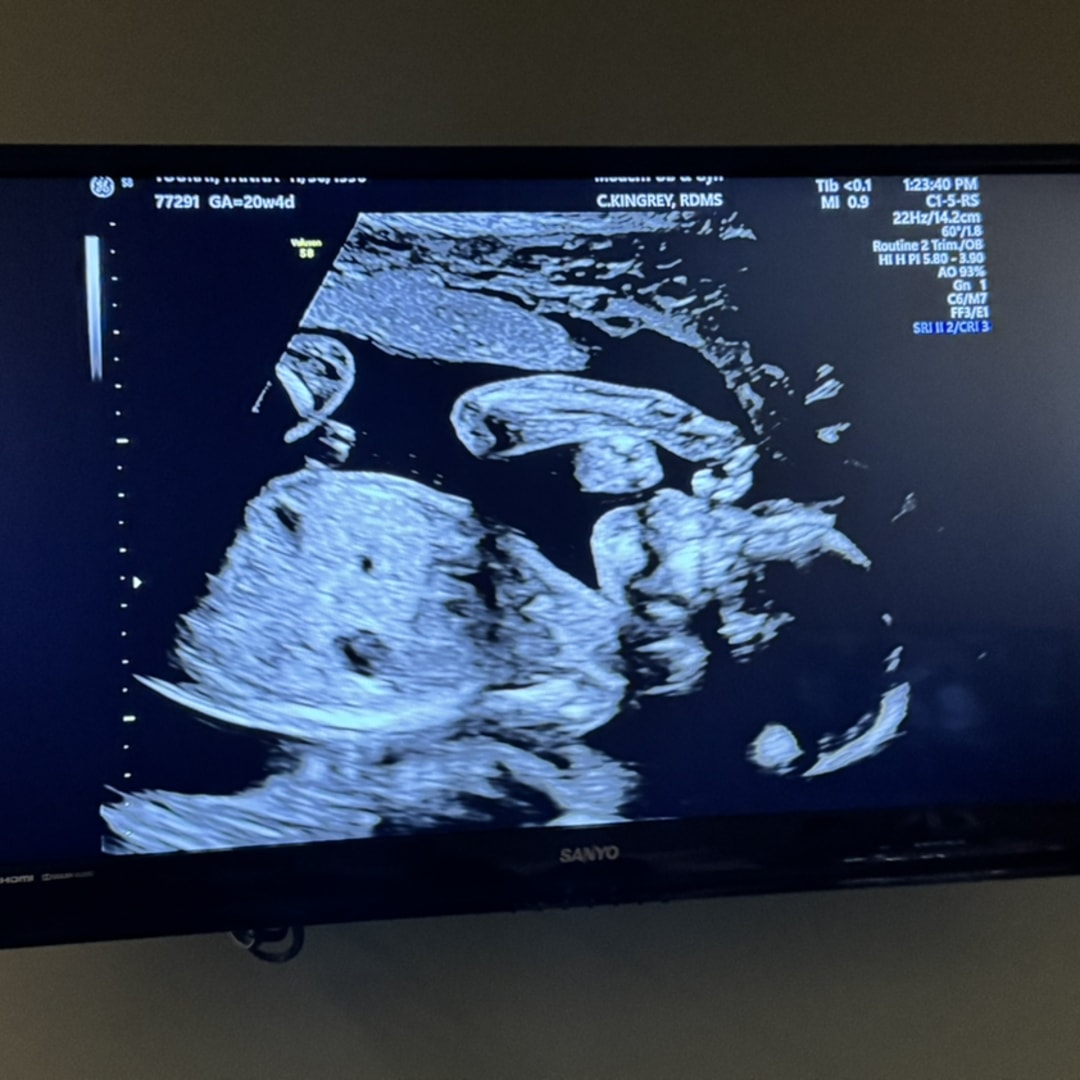 Photo shared by Fanna for their Babylist baby registry.