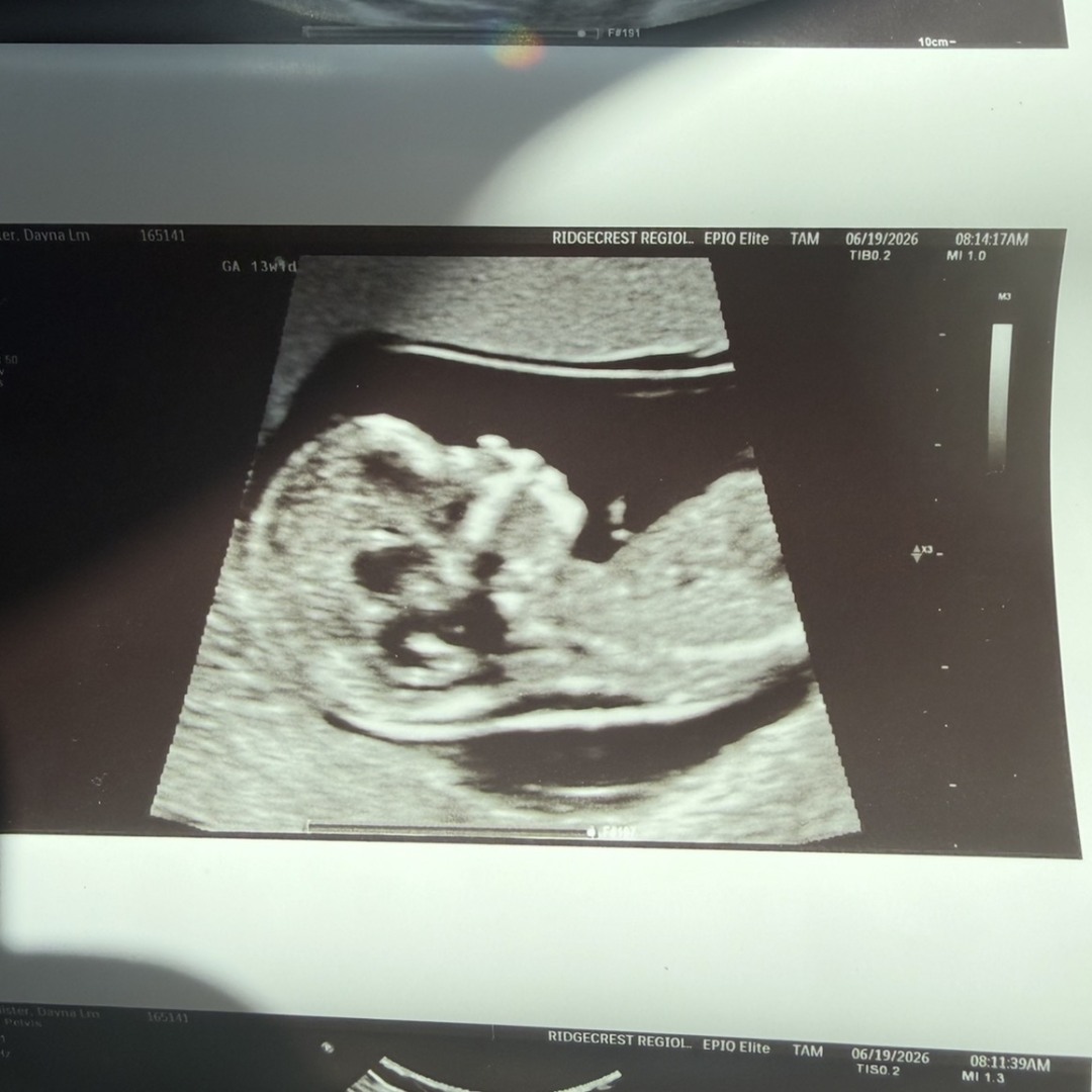 Photo shared by Dayna for their Babylist baby registry.