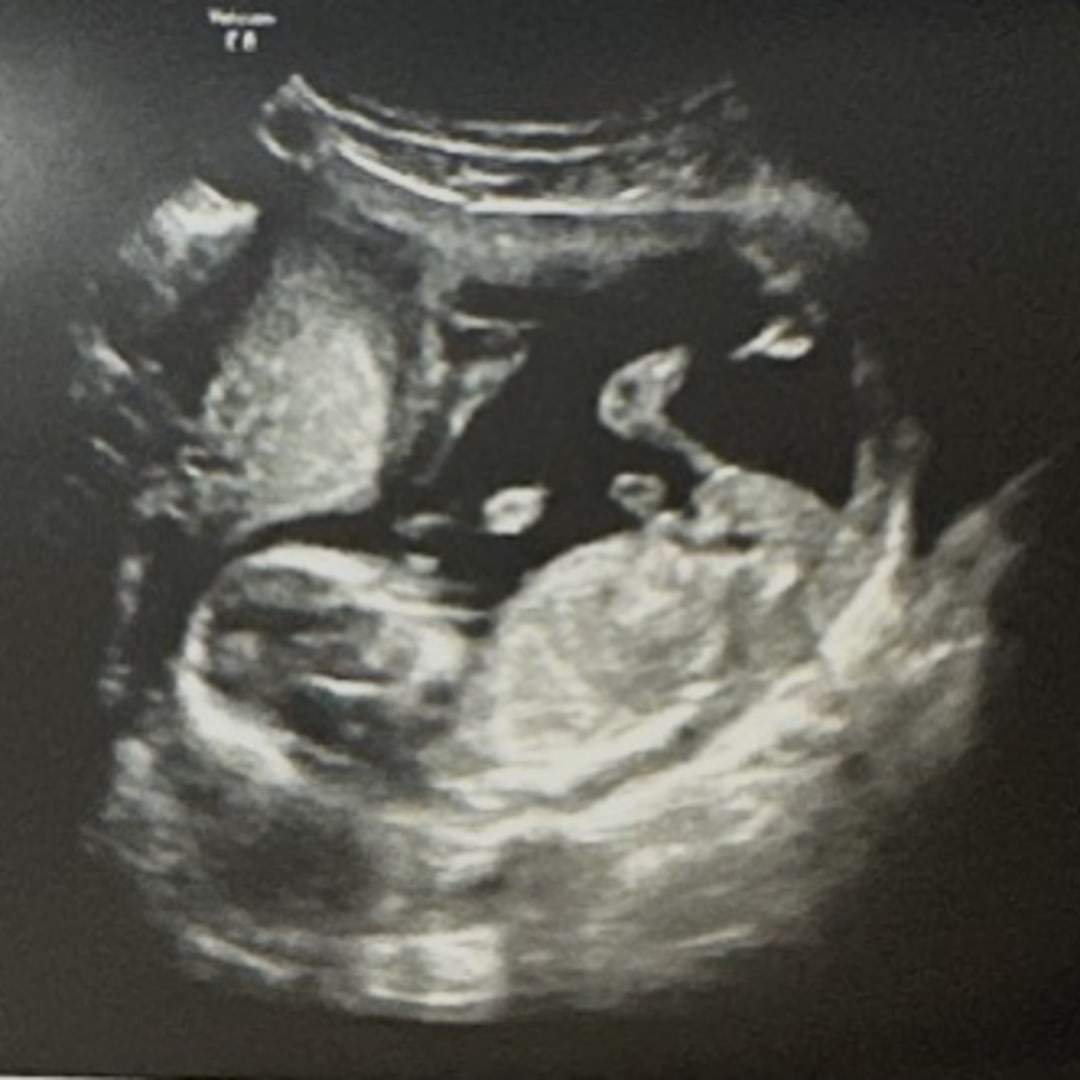 Photo shared by Kendal for their Babylist baby registry.