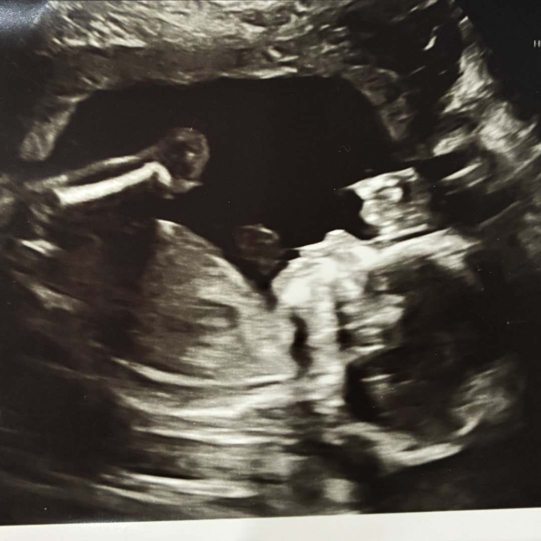 Photo shared by Jennifer for their Babylist baby registry.