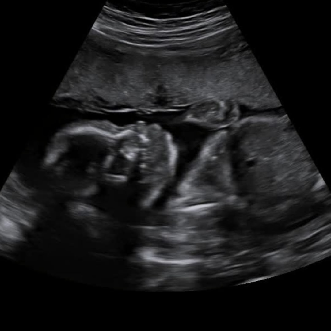 Photo shared by Josey for their Babylist baby registry.