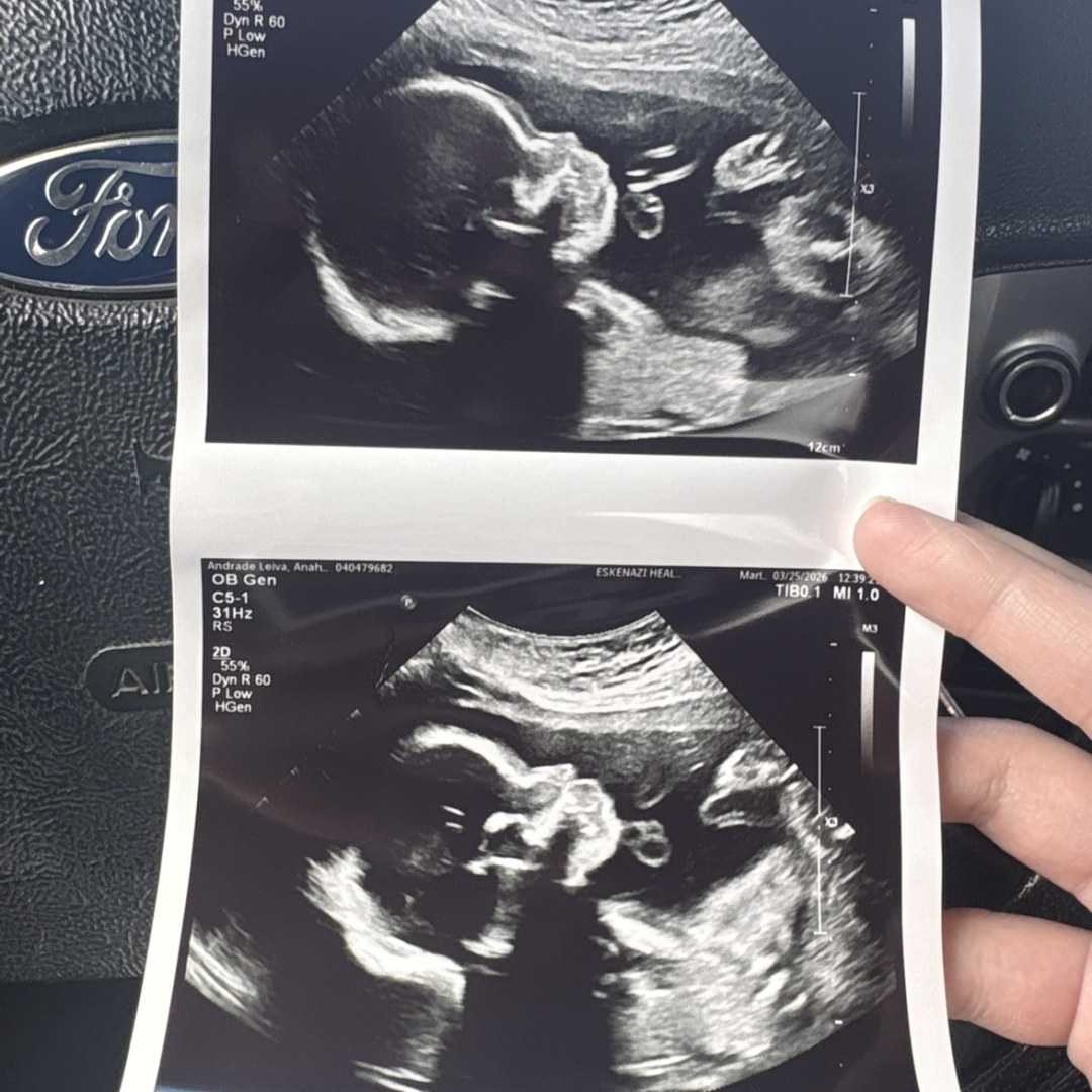 Photo shared by Anahi for their Babylist baby registry.