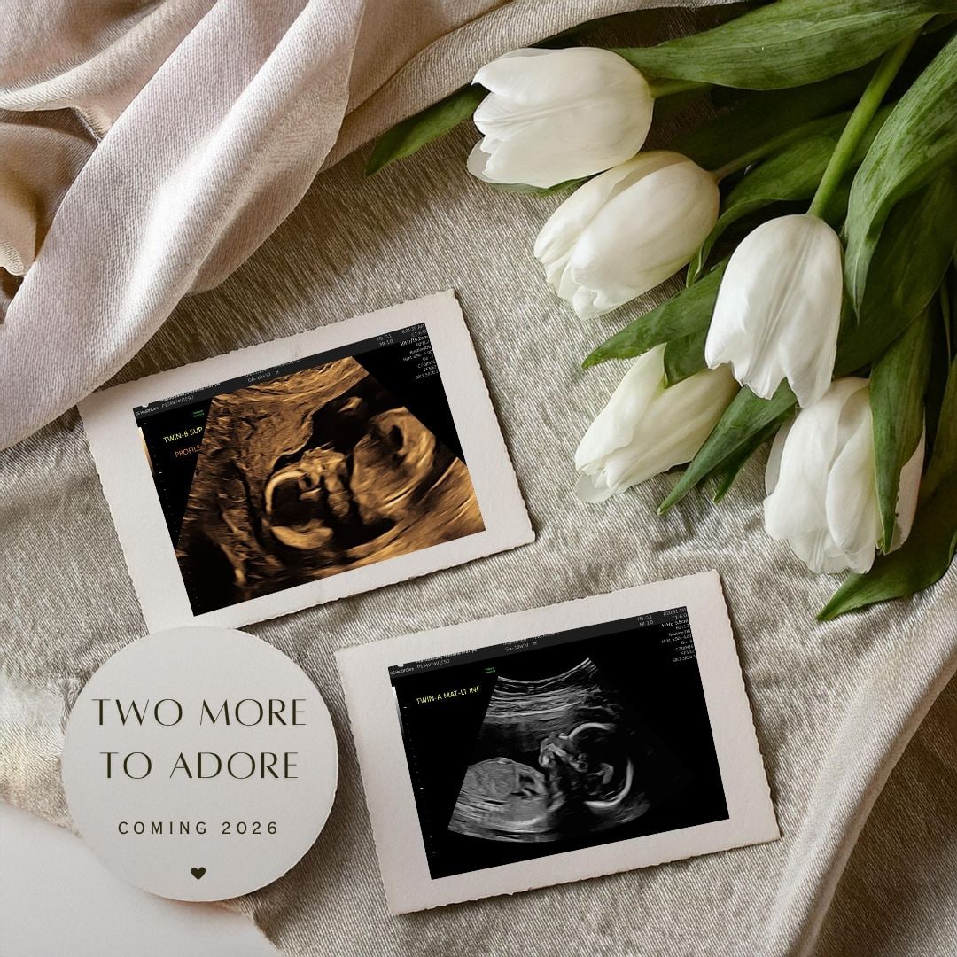 Photo shared by Jemima for their Babylist baby registry.