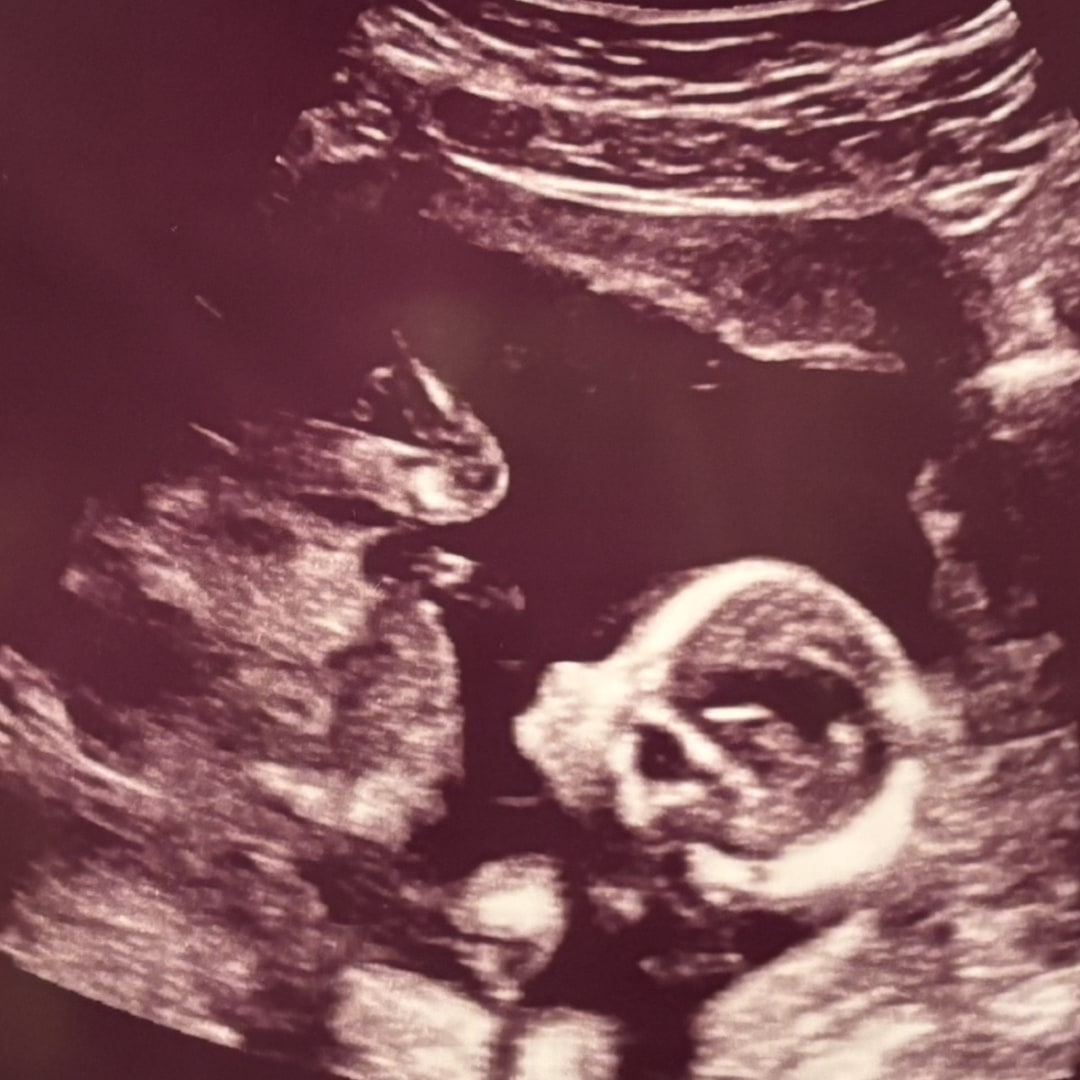 Photo shared by Meg for their Babylist baby registry.