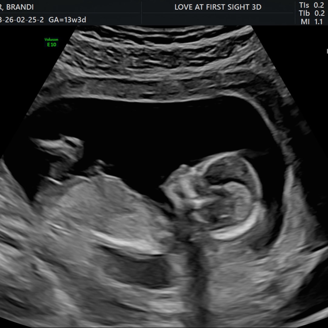 Photo shared by Brandi for their Babylist baby registry.