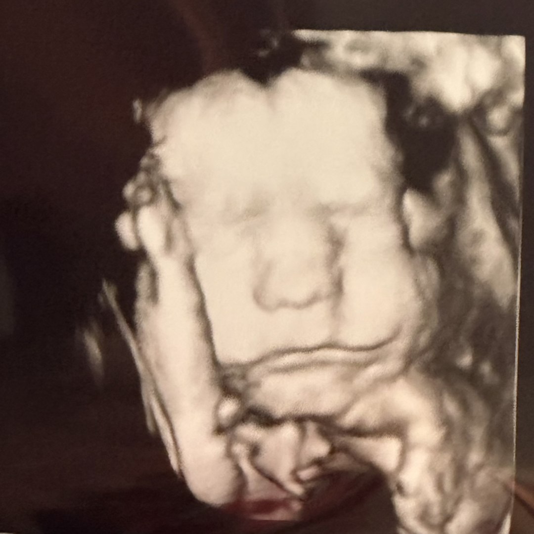 Photo shared by Emma for their Babylist baby registry.