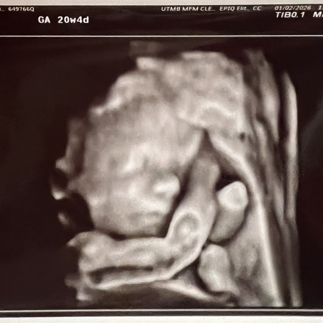 Photo shared by Rebekah for their Babylist baby registry.