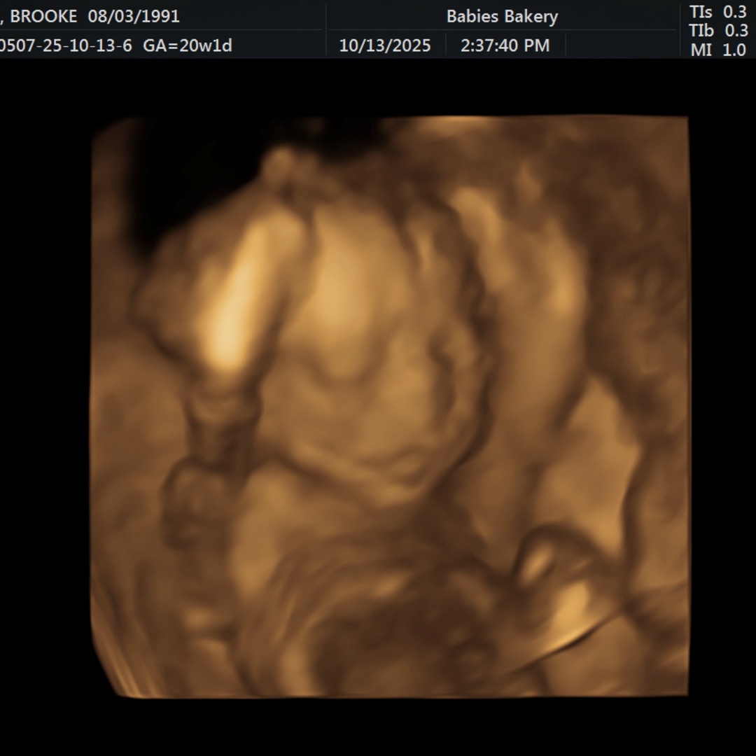 Photo shared by Brooke for their Babylist baby registry.