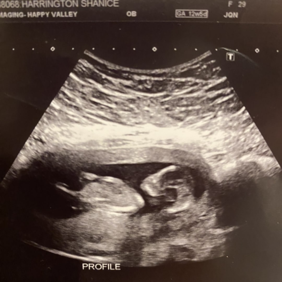 Photo shared by Shanice for their Babylist baby registry.