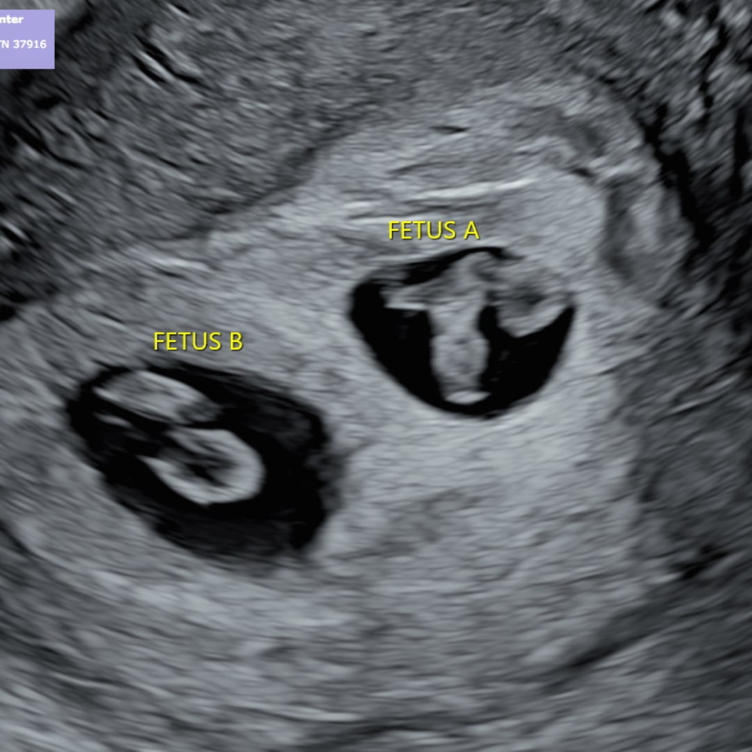 Photo shared by Alexis for their Babylist baby registry.