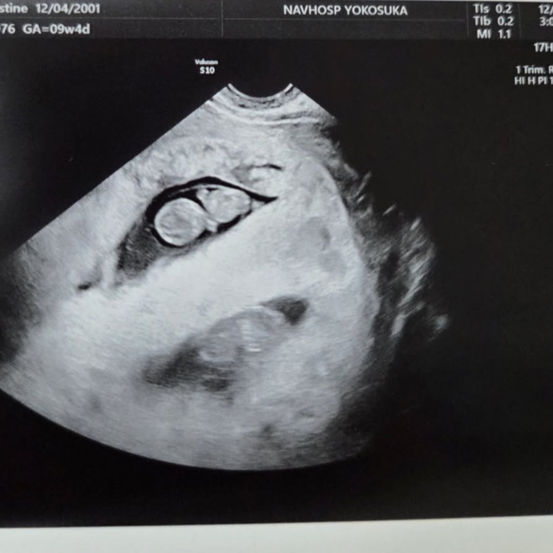 Photo shared by Christine for their Babylist baby registry.