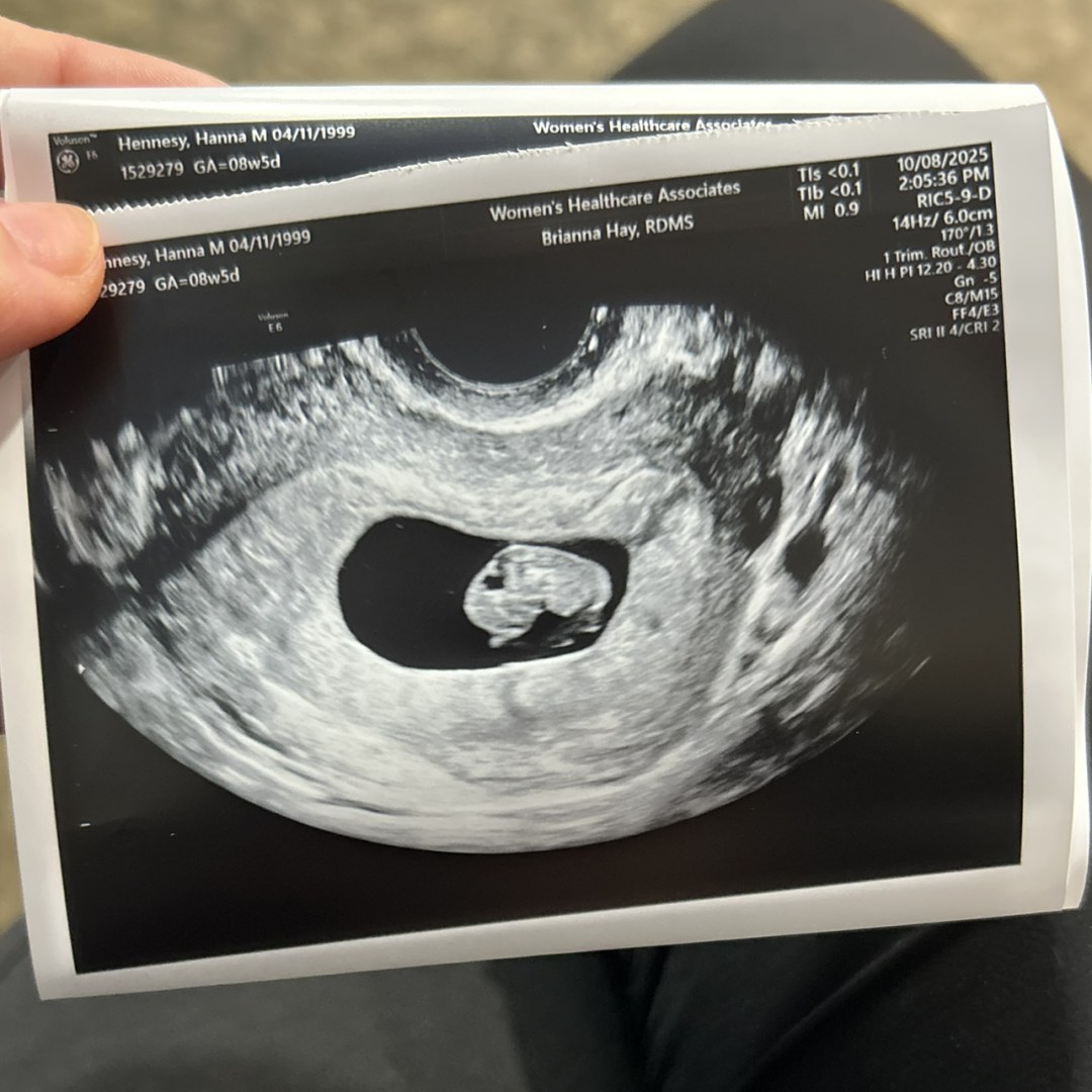 Photo shared by Hanna for their Babylist baby registry.