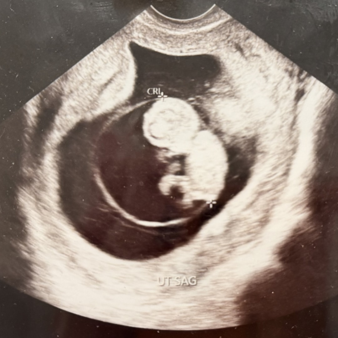 Photo shared by Sara for their Babylist baby registry.