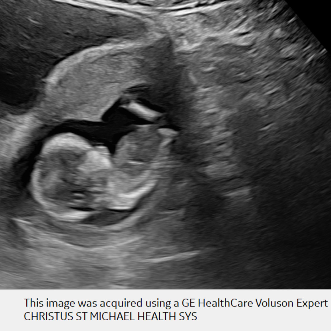 Photo shared by Lizzy for their Babylist baby registry.