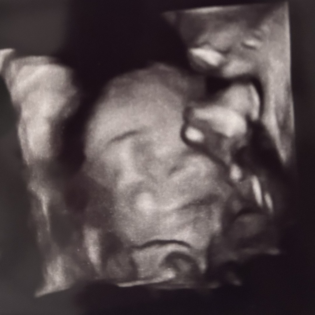 Photo shared by Claudia for their Babylist baby registry.