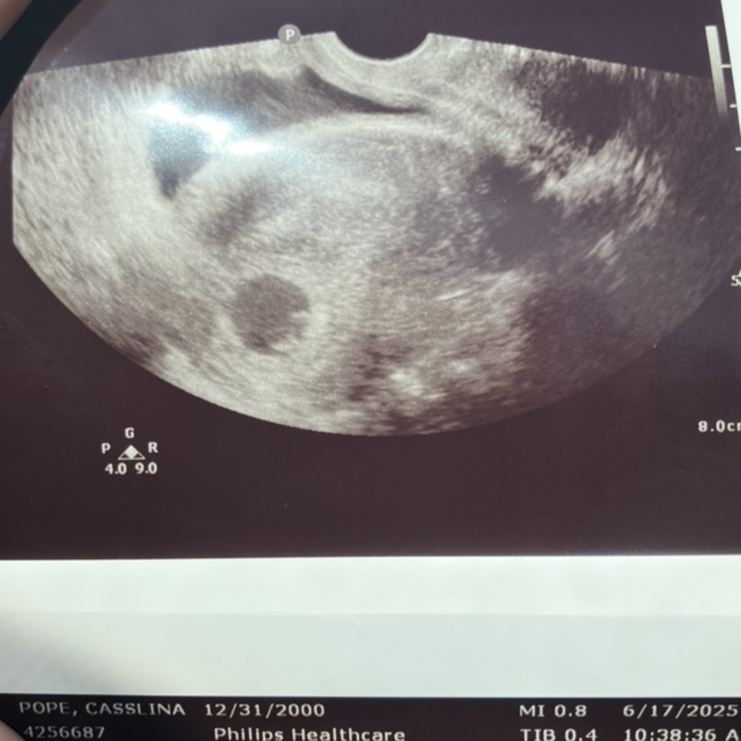 Photo shared by Cassy for their Babylist baby registry.