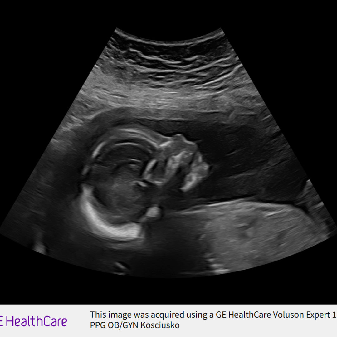 Photo shared by Crystal for their Babylist baby registry.