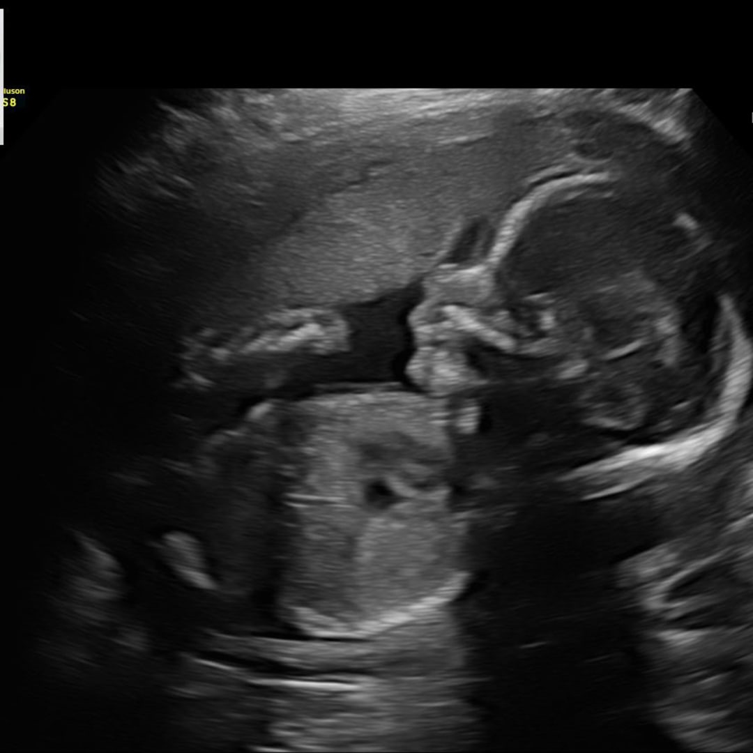 Photo shared by Ryian for their Babylist baby registry.