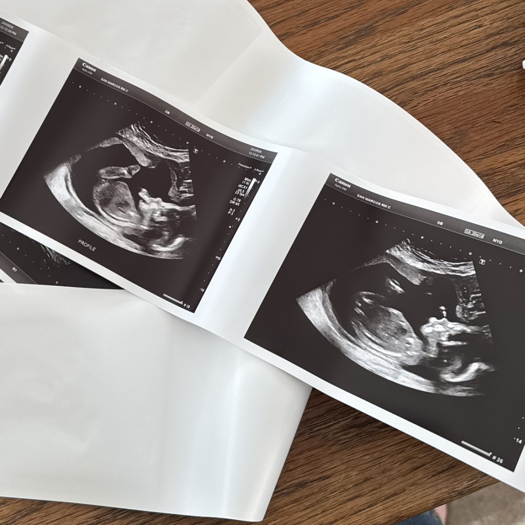 Photo shared by Jenna for their Babylist baby registry.