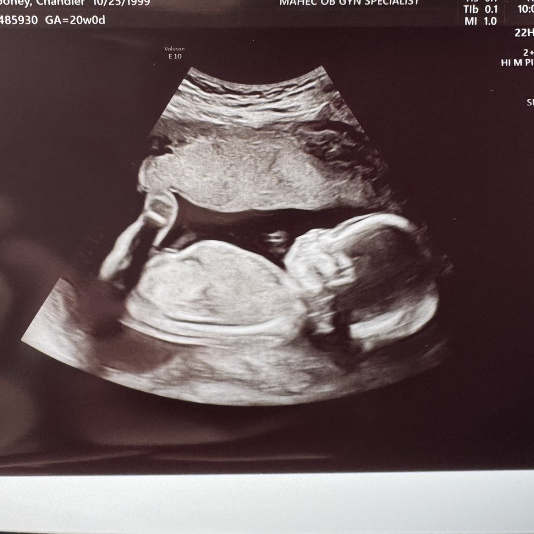 Photo shared by Chandler for their Babylist baby registry.