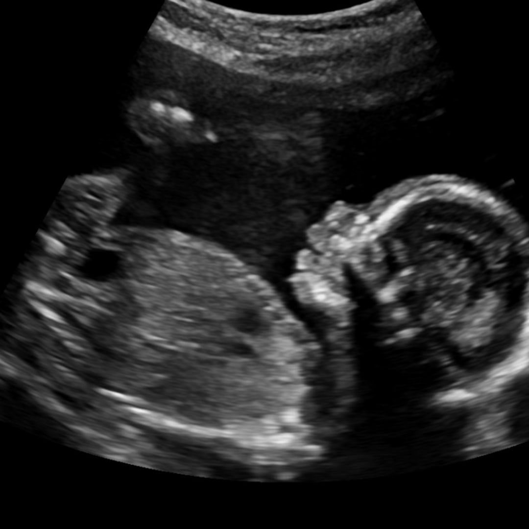 Photo shared by Michaela for their Babylist baby registry.