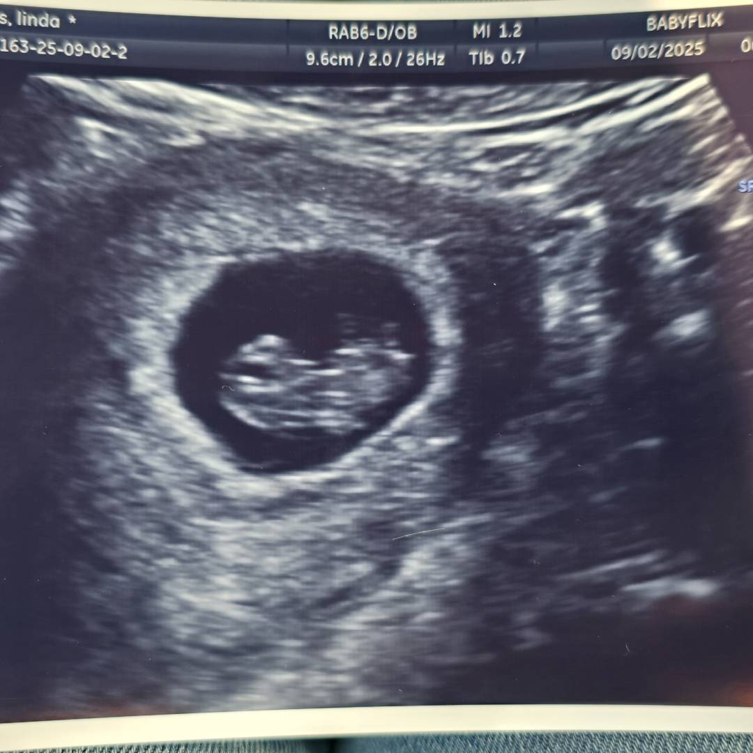 Photo shared by Linda for their Babylist baby registry.