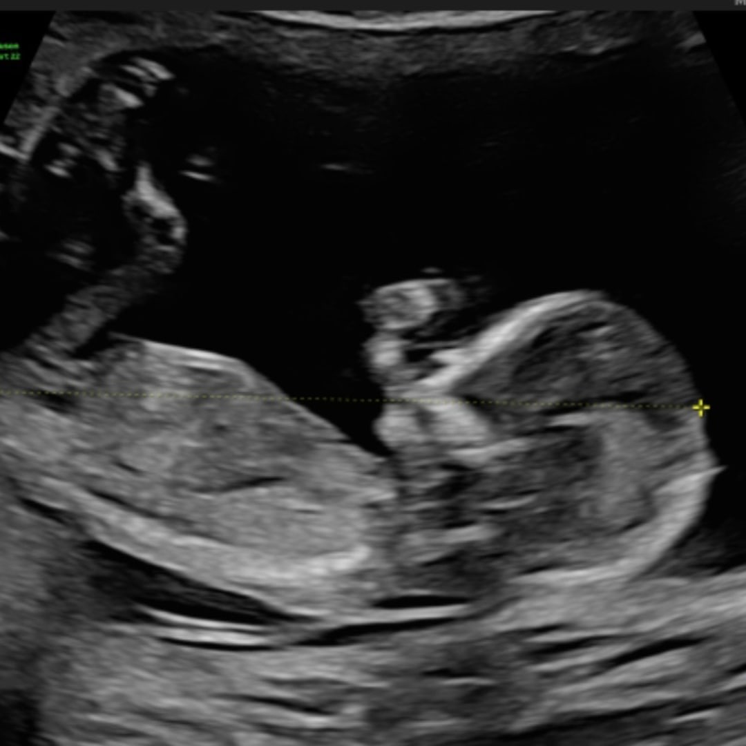 Photo shared by Natashia for their Babylist baby registry.