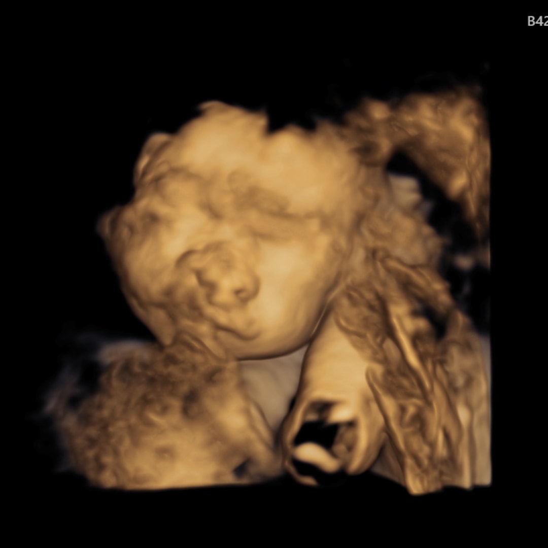 Photo shared by Brooke-Lynn for their Babylist baby registry.