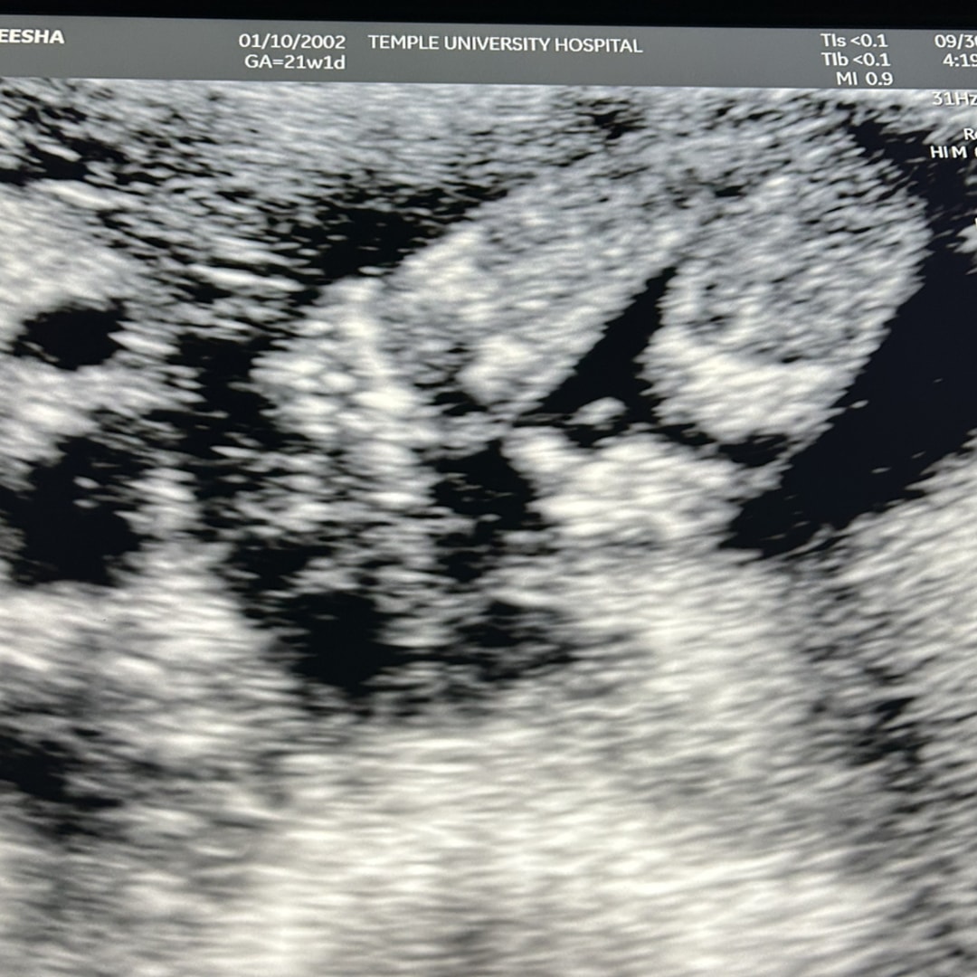 Photo shared by Myeesha for their Babylist baby registry.