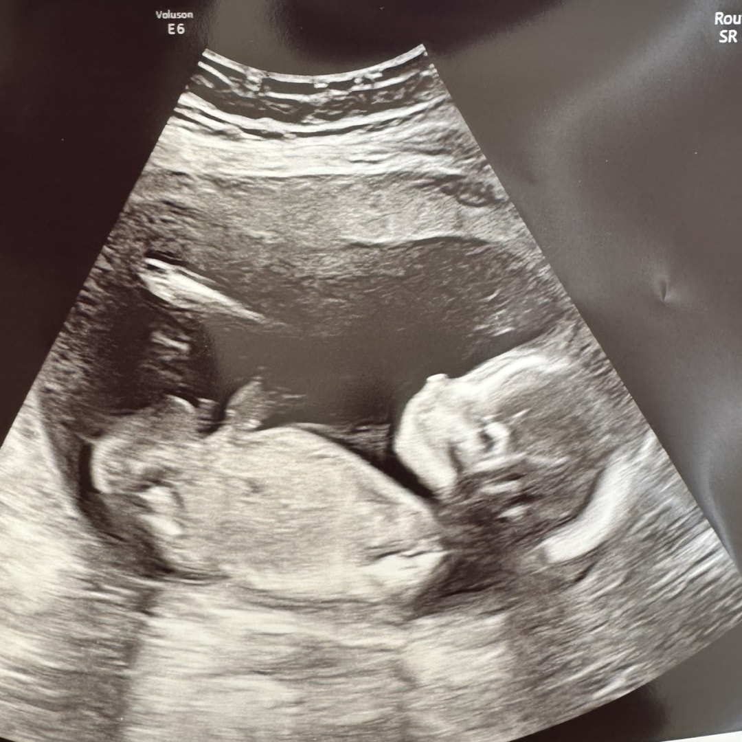 Photo shared by Aly for their Babylist baby registry.