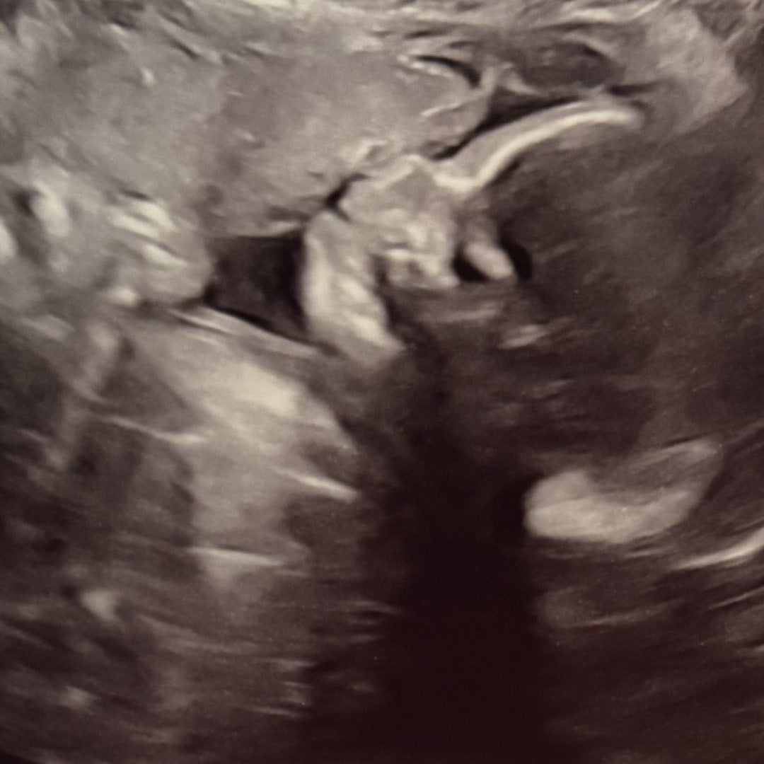 Photo shared by Hailey for their Babylist baby registry.