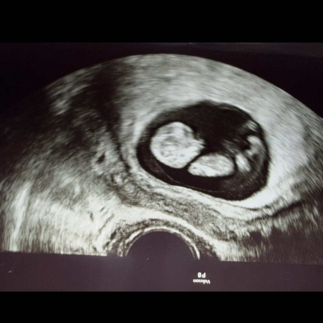Photo shared by Hannah for their Babylist baby registry.
