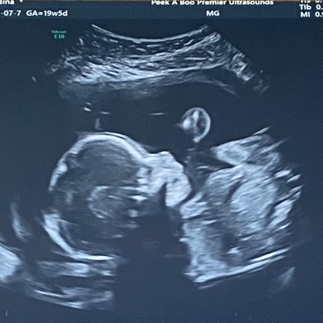 Photo shared by Rosina for their Babylist baby registry.