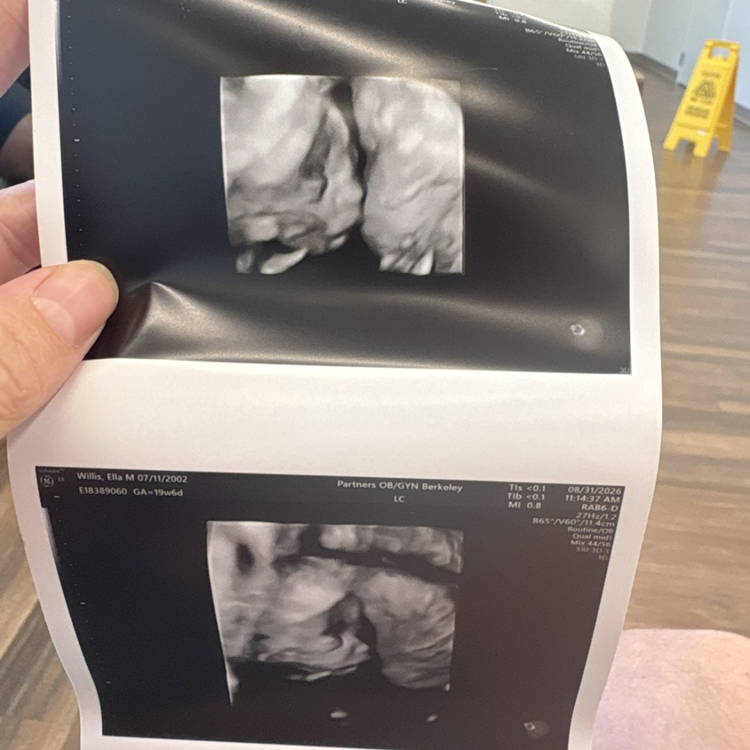 Photo shared by Ella for their Babylist baby registry.