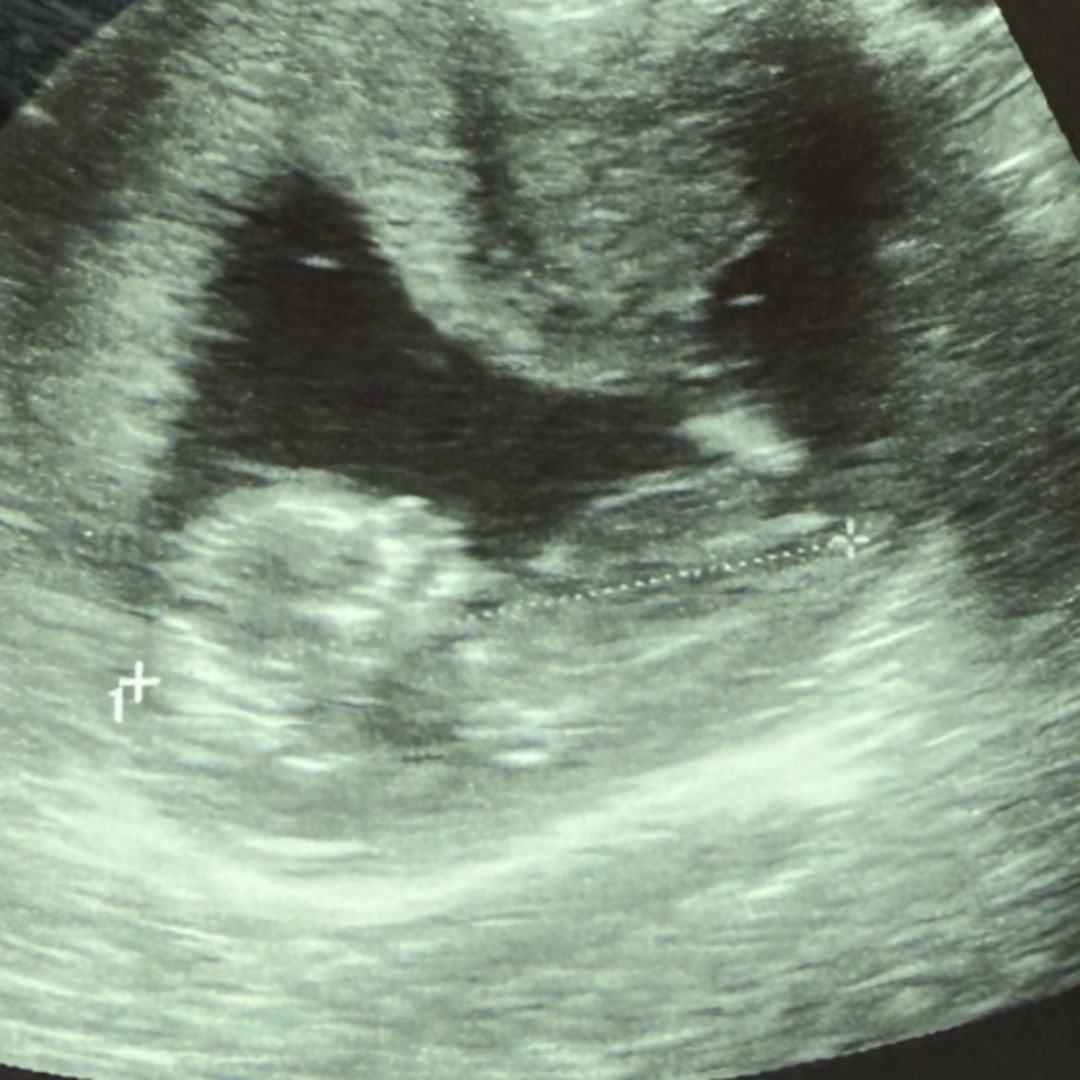 Photo shared by Kylee for their Babylist baby registry.