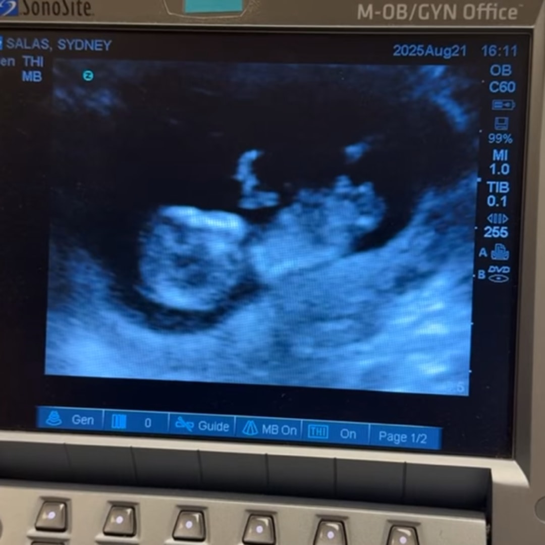 Photo shared by Sydney for their Babylist baby registry.