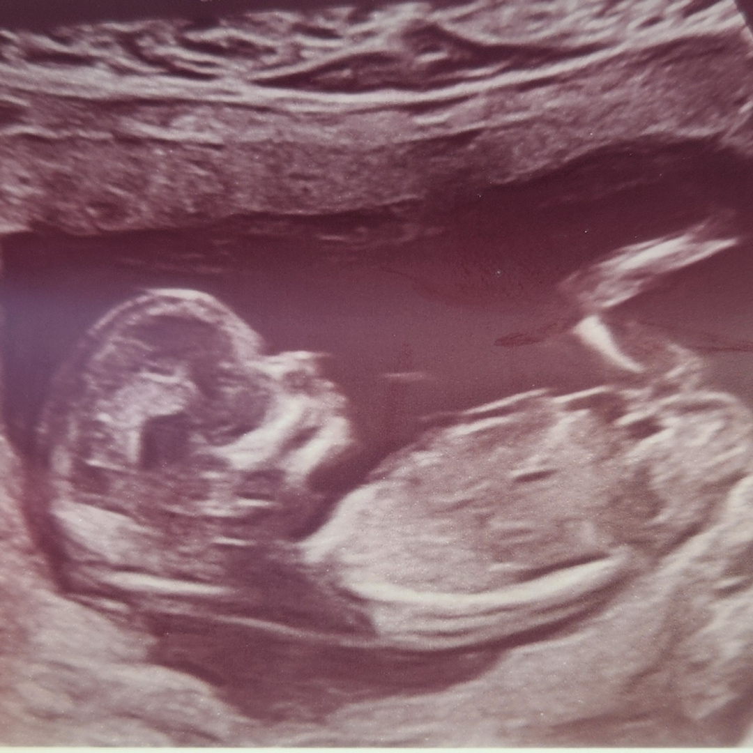 Photo shared by Kaitlyn for their Babylist baby registry.