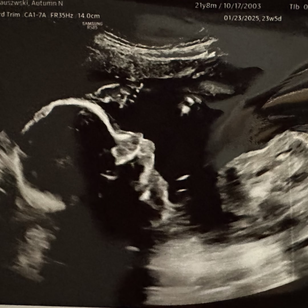 Photo shared by Autumn for their Babylist baby registry.